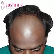 Before and after pictures of Sushruta Cosmetic & Plastic Surgery