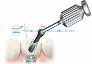 Custom Abutment | Advance Dental Lab China