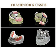 Metal Framework | Dental Laboratory China