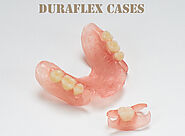 DuraFlex | China Dental Laboratory