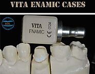 Vita Enamic | China Digital Dental Lab