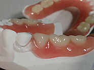Chinese Dental Lab Denture