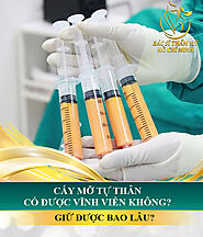 Cấy mỡ tự thân có được vĩnh viễn không? Giữ được bao lâu?