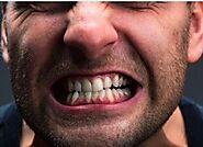 Teeth Grinding/Bruxism