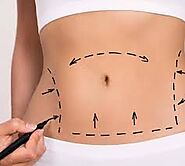 What is the Difference Between a Full Tummy Tuck and a Mini Tummy Tuck?