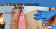 Tips To Stay in Shape After Liposuction Surgery