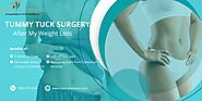 Do I Need A Tummy Tuck After My Weight Loss Surgery?
