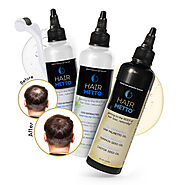 HAIRMETTO® Hair Restoration KIT with Titanium Scalp Dermaroller for Ha – HAIRMETTO
