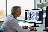 Exploring the Impact of TMS on Brain Health: What You Need to Know