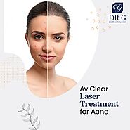 AviClear laser Treatment for Acne | Cosmetic Dermatologist in Ellicott City