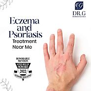 Eczema & Psoriasis Treatment Near Me