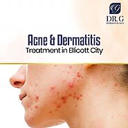 Acne & Dermatitis Treatment in Ellicott City