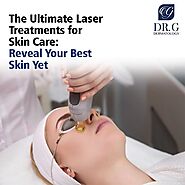 The Ultimate Laser Treatments for Skin Care: Reveal Your Best Skin Yet