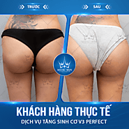 Điều trị thâm mông tại Viện Thẩm Mỹ Quốc Tế Medic Skin