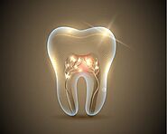 Affordable Root Canal Treatment Edmonton | Edmonton Smiles