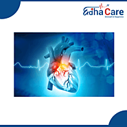 Who is a cardiologist ? Heart Doctors and Specialist | EdhaCare