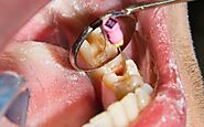 Periodontist | Vancouver Island Dental Specialists | Nanaimo