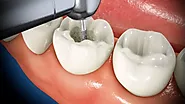 Dentist | Dr. John Fabbro | Ontario