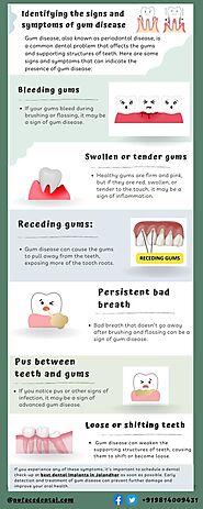 Identifying the signs and symptoms of gum disease | Patreon