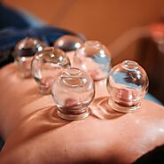 Cupping Therapy | BWM Acupuncture