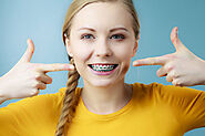 Can Braces Change One’s Facial Appearance? Here are Things to Know