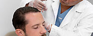 Hair Transplant Cost for Men - Dr Lokesh Handa