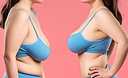 Breast lift surgery in Delhi - Dr Lokesh Handa