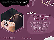PRP Treatment for Hair