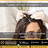 Exploring Different Types of Hair Transplant Procedures - Dermatologist in Roorkee
