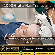 1000 Grafts Hair Transplant - Dermatologist in Roorkee