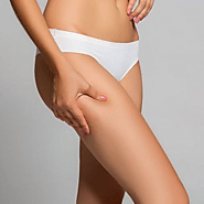 Is a Thigh Lift the Right Surgery for you?