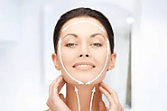 Know About Facelift Surgery