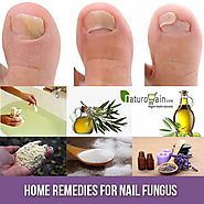 6 Superb Home Remedies For Nail Fungus- Get Rid Of Toenail Onychomycosis