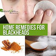 5 Home Remedies for Blackheads Removal - Quick And Simple Methods
