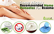 6 Highly Recommended Home Remedies For Eczema