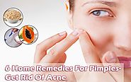 6 Home Remedies For Pimples- Get Rid Of Acne Quickly!