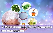 7 Most Amazing Home Remedies for Blackheads On Face