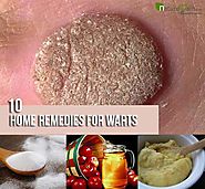 10 Home Remedies For Warts- Effective Natural Treatment