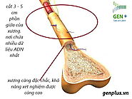 Xét Nghiệm ADN Mẫu Xương Được Không ?