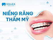 Niềng răng – Bí quyết cho hàm răng đều đẹp