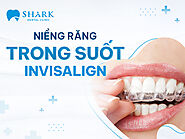 Niềng răng trong suốt INVISALIGN - Giải pháp chỉnh nha hoàn hảo