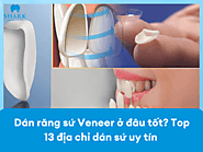 Dán răng sứ Veneer ở đâu tốt? Top 13 địa chỉ dán sứ uy tín 