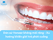 Dán sứ Veneer không mài răng – Xu hướng khiến giới trẻ phát cuồng