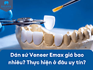 Dán sứ Veneer Emax giá bao nhiêu? Thực hiện ở đâu uy tín?