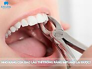 Nhổ răng cửa bao lâu thì trồng răng implant lại được như bình thường?