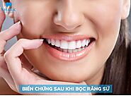 Cảnh báo những biến chứng sau khi bọc răng sứ kém chất lượng