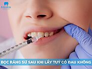 Giải đáp: Bọc răng sứ sau khi lấy tủy có đau không?