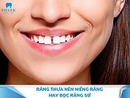 Răng thưa nên niềng hay bọc sứ? Phương pháp nào tốt hơn?