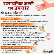 Chemical Burns Treatment | Infographics in Hindi