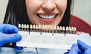 Illuminate Your Smile: Modern Innovations in Teeth Whitening